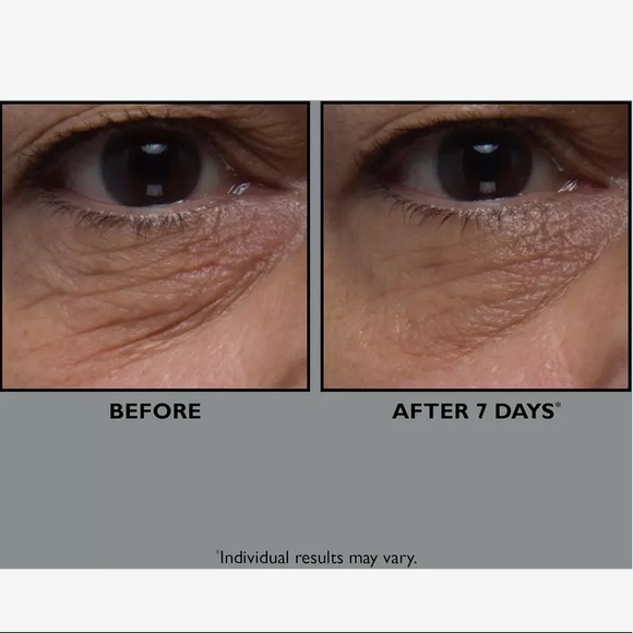 Peter Thomas Roth FIRMx Collagen Eye Cream - Picture 4 of 6